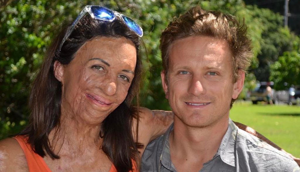 Inspirational Athlete And Burns Survivor Turia Pitt Announces Her Pregnancy Mum S Lounge