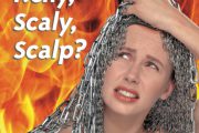 itchy scaly scalp coco scalp