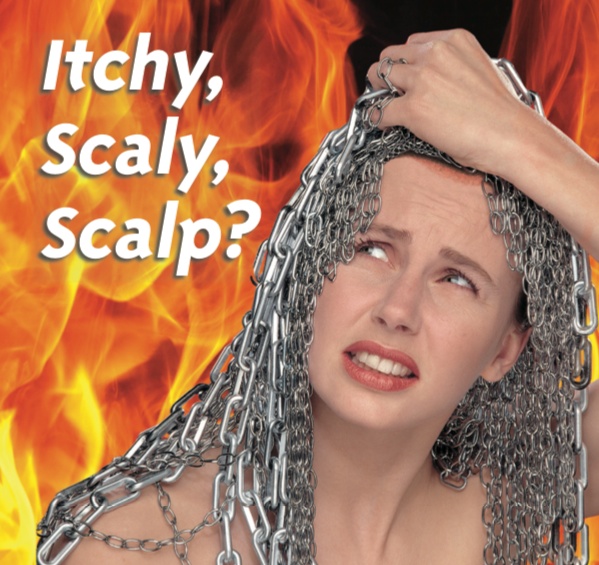 itchy scaly scalp coco scalp