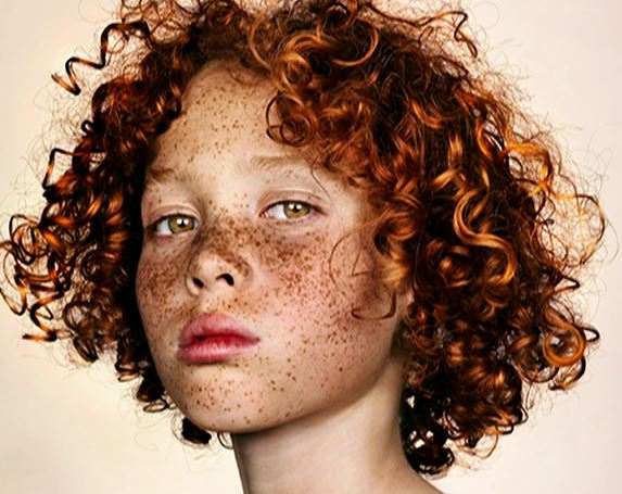 Freckle Photography