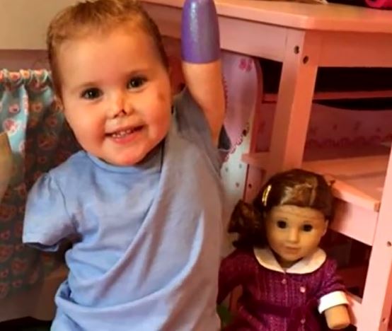 Two-Year-Old Girl Who Lost Limbs Receives Doll Just Like Her - Mumslounge