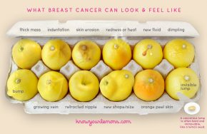 breastcancer photo