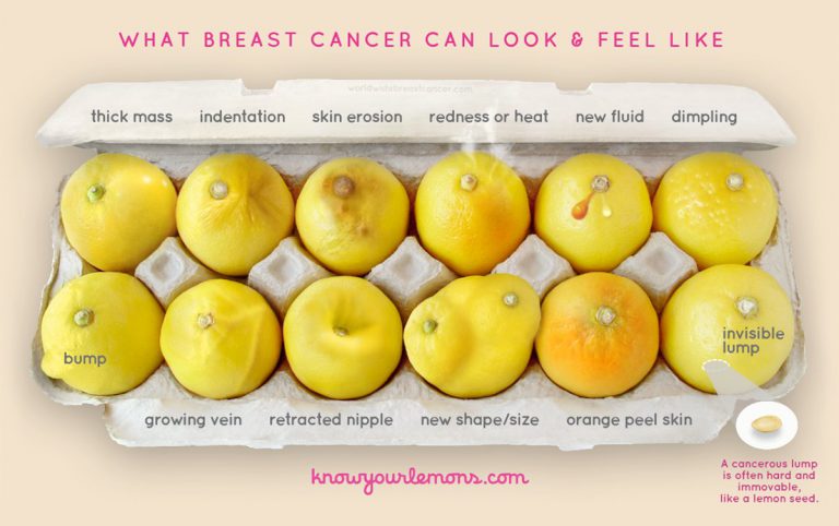 breastcancer photo