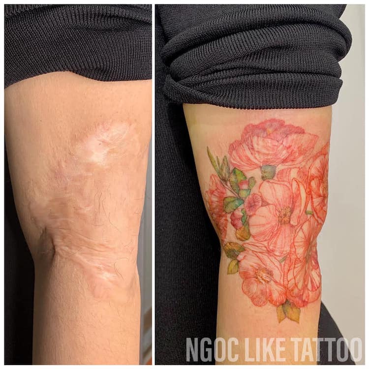 Tattoo Artist Helps Women Regain Confidence by Covering Their Scars With  Beautiful Artworks - Mumslounge